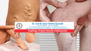 Angiólogo en Cancún Dr. Fuentes Quezada