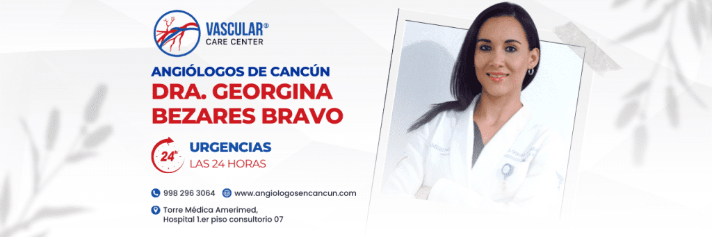 Angióloga en Cancún Dra. Georgina Bezares Bravo