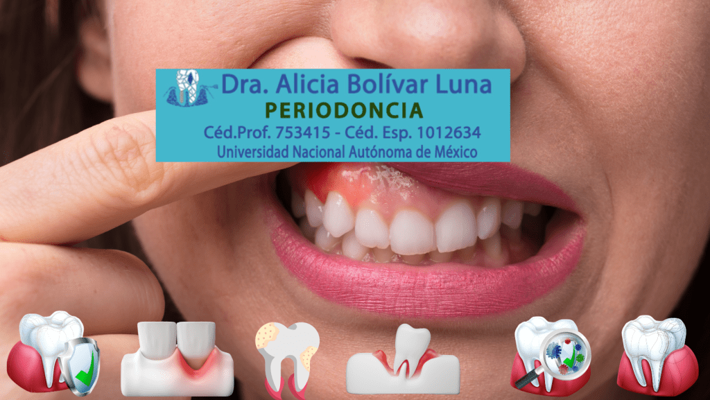 Periodoncia en Cancún