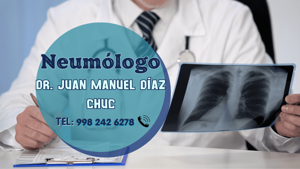 Neumólogo en cancún Dr. Juan Manuel Diaz Chuc